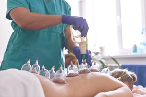 hijama-cupping